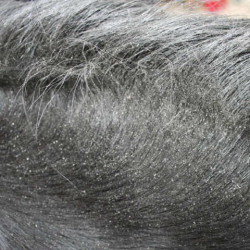 Repelente Animaderm Derfly Repelente Animaderm Derfly