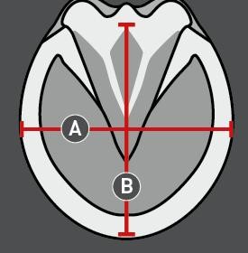 Ilustração do guia de tamanhos para Hipossandálias cavalo Equine Fusion